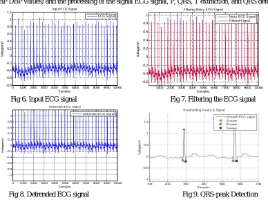 Fig 6. Input ECG signal                                                      Fig 7. Filtering the ECG signal 