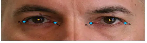 Figure 2. Reference Points selected for cropping Periocular ROI 