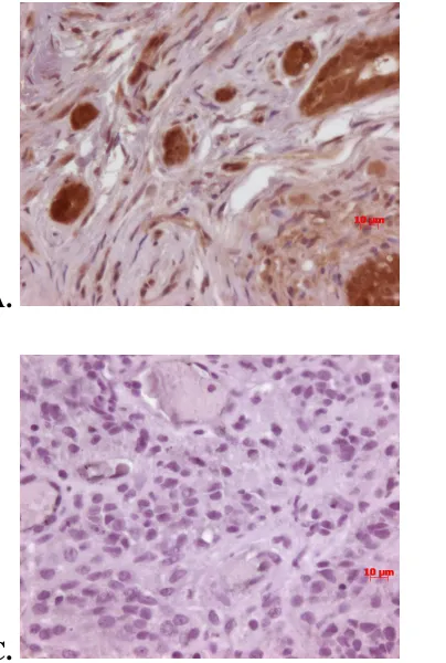 Figure 4-14 IHC staining of PLGA for OPN, CD44, and integrin αvβ3 at 400x 