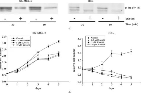 Figure 1. The inhibitory effects of the Src inhibitor SU6656 on Src phosphorylation (a) and proliferation rate (b) of SK-MEL-5 and HBL melanoma cells