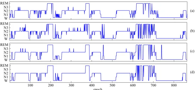Figure 7: Hypnogram of one subject of the MASS dataset (subject 22 of the subset SS1 [36]): (a) ground-truth, (b) the one-to- one-to-one baseline framework’s output, (c) the many-to-one-to-one baseline framework’s output, (d) the proposed one-to-one-to-man