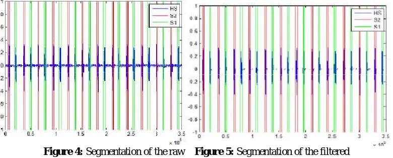 Figure 4: Segmentation of the raw    Figure 5: Segmentation of the filtered heart sound 201108011118.wav