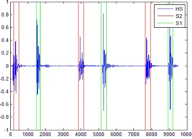Figure 18: Segmentation steps for the raw heart            Sound106_1306776721273_C2.wav
