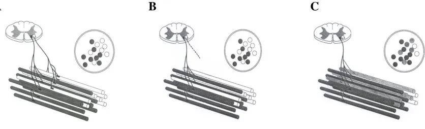 Figure 1.1 Collateral reinnervation.  Two functioning MUs are depicted with their motor neurons located in the anterior horn of a cross-section of the spinal cord and their peripheral axons innervating respective groups of muscle fibers
