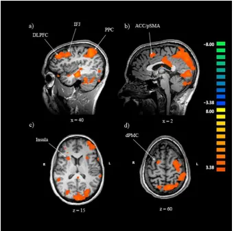 Figure 3. Neural regions showing greater activation during task switch trials than task 