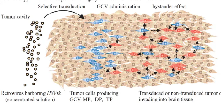 Figure 1. Strategy of suicide gene therapy against glioblastoma. tumor cells to migrate and disperse into tumor tissues, non-transduced cells distant from the cavity can be effectively killed via the bystander effect.neighboring cells through gap junctions