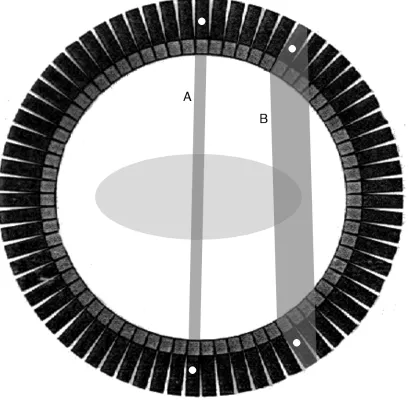 Figure 1.5: Impact of detector size on LOR localization. The outer ring is a cylindri-cal array of PET detectors