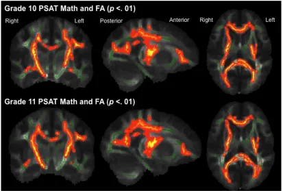Figure 2: White matter structures showing a positive correlation with FA and PSAT math scores in Grade 10 and Grade 11