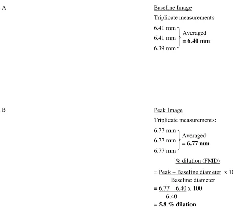 Figure 2.3 Example calculation of baseline diameter (A) and peak diameter and FMD (B) for a representative subject