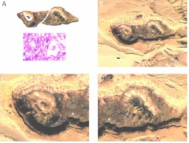Figure 19. Aerial photography. A, show detachment and comparative microscopic GTCHC analisis image with B-D, geologic monumental triangular mirror image structures, associate with chiral white-black, head-tail geomorphic patterns embedded on the rock surfa