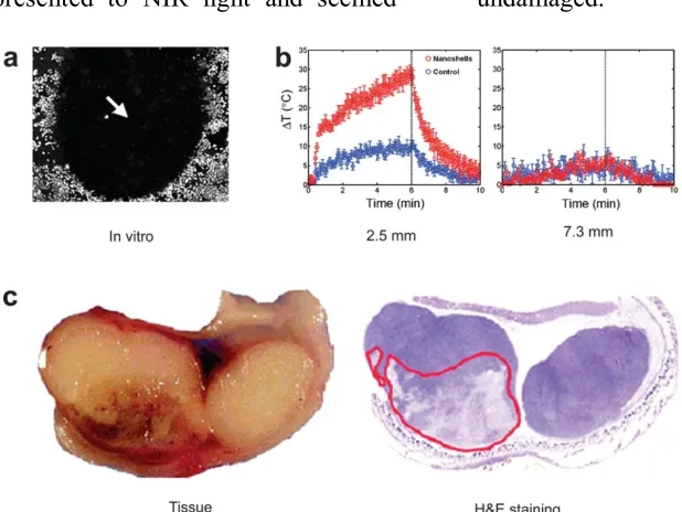 Figure 1: Gold nanoshells can pulverize 