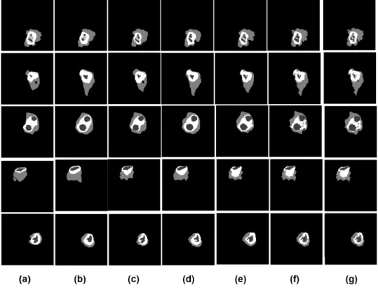 Figure 4: Qualitative segmentation results for all the baseline methods applied on 5 subjects: