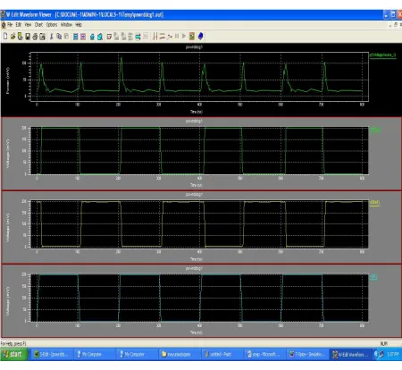 Fig. 4 Data driven clock gating waveforms.  