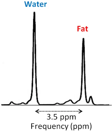 Figure 1.2: A representative frequency spectrum of the MRI signal, showing two 