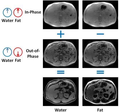 Figure 1.3: The two-point Dixon method reconstructs water and fat images by 