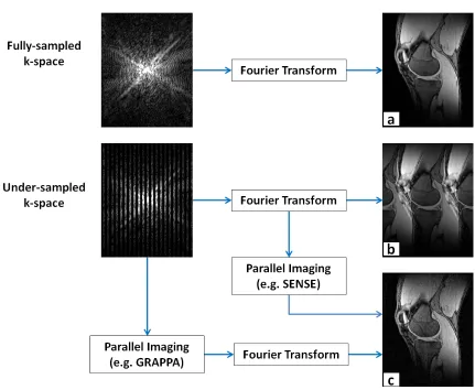 Figure 1.8: (a) A knee image obtained from the Fourier transform of a fully-sampled k-space