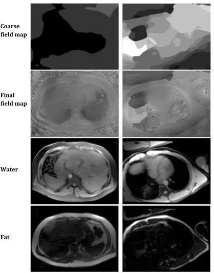 Figure 2.2: Left column: axial abdominal slice, Right column 4-chambers cardiac 