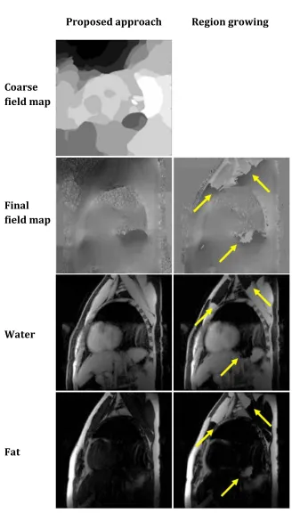 Figure 2.3: Comparison between our approach (left column) and the region-growing 
