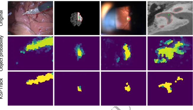Figure 5: (Top row): Original images from different datasets. Ground truth contour of the structure of interest is depicted in red and the supervised 2D locations are shown in green
