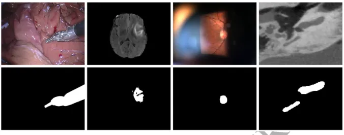 Figure 1: Example of objects of interest in different video and volumetric modalities