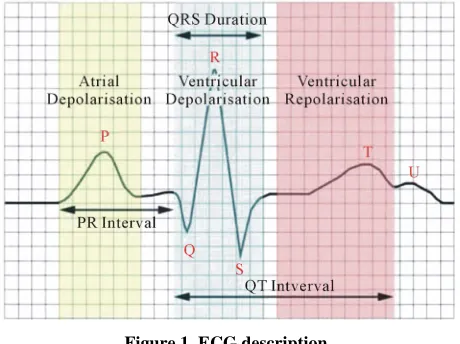 Figure 1. ECG description. 