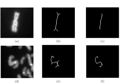 Figure 3.7: Two chromosomes and their skeletonization [3] and morphological