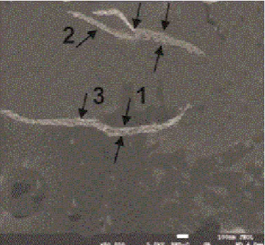 Figure 1. The TEM images of the suspension of amylin, aggregated for 7 days incubation in 20 mM HEPES buffer, pH 7.2, at 37˚C