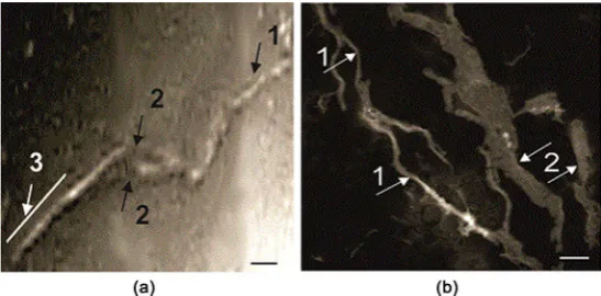 Figure 3. The SEM pictures of the suspension of amylin, aggregated in the presence of 50 - 60 nm, arrows 2—the longitudinal breakthrough forms of the fibrils, arrow 3—the spiralized part of the fibrils; (b) the amorphous bundles of fibrils without clear co