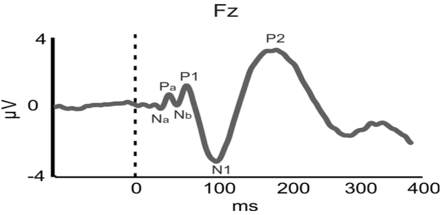 Figure 4: Sample ALLR waveform (adapted from information presented by Shahin, 