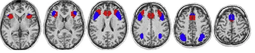 Figure 1: Extracted networks from MD (Hampshire et al., 2012). The ventral network 