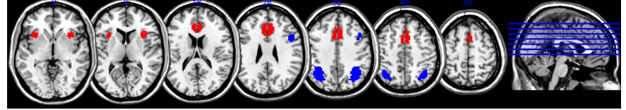 Figure 5: Extracted ICA components from experiment 1. The ventral network (red) 