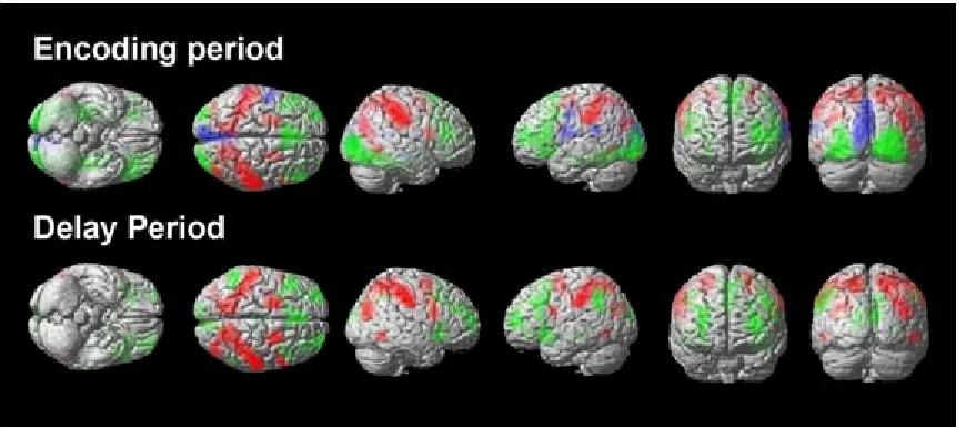 Figure 9: Whole-brain analyses of stimulus-specific activations. The figure depicts 