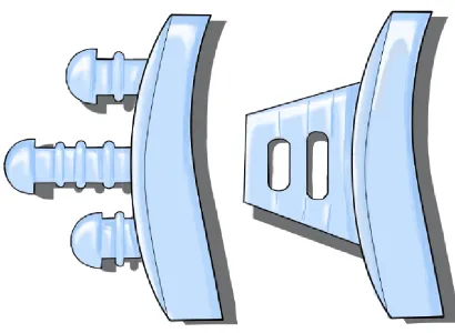 Figure 1.6: TwoTwo Types of Glenoid Component: Pegged and 
