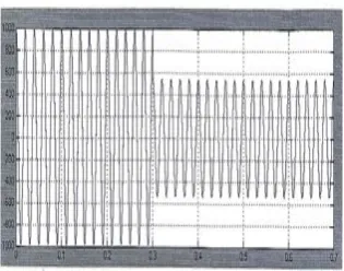 Fig 3(e) & 3(f) respectively. The load Voltage reaches the normal value due to the injection from the STATCOM [7-9]