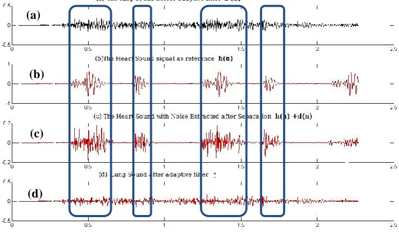 Fig. 7 Waveforms before and after application of adaptive filter:  reference input recorded at the same time with x(n); ((a) Original signal of x(n); (b) HS is considered a c) HS and noise extracted from x(n); (d) desired output signal