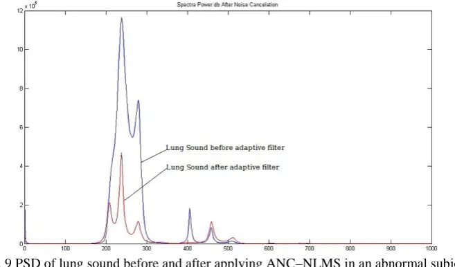 Fig. 9 PSD of lung sound before and after applying ANC–NLMS in an abnormal subject  