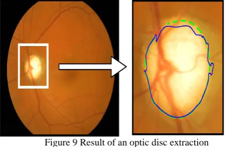 Figure 8 Comparison of C/D ratio measured by an ophthalmologist and the proposed method   