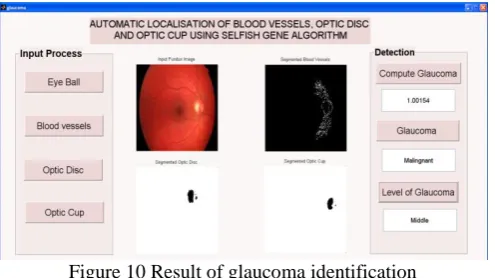 Figure 10 Result of glaucoma identification  