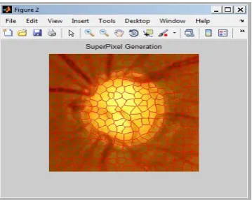 Fig 5 Superpixel generation from data base 