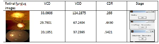 Fig 13 Compare output of various image 