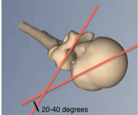 Figure 1-3. Humeral Head Retroversion  