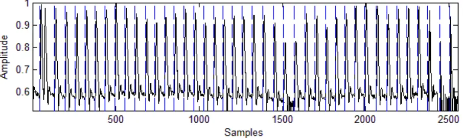 Fig. 2. Envelope of maximum frequencies of a Doppler blood flow signal.  