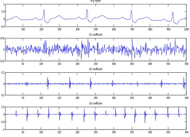 Fig (4) input ECG signal with corresponding d1, d2, d3 detailed coefficients  