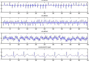 Fig (5) d4, d5, d6 detailed, a6 coefficient and reconstructed signal (d3+d4+d5+a6) 