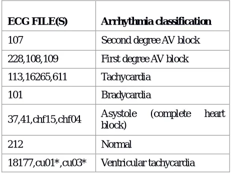 Table. (2) Calculated parameters from our algorithm for some ECG samples     