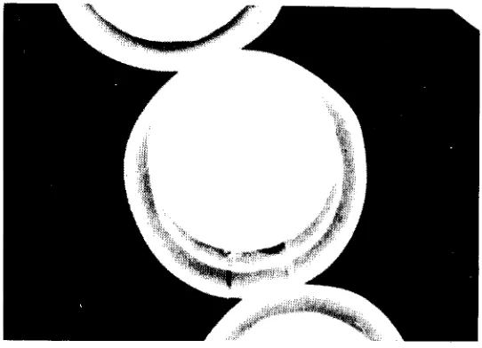 Fig. 8 Particle B after the final heat treatment ~artly obscured by 