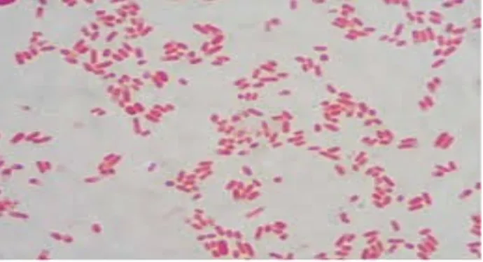 Figure 8: E.coli 