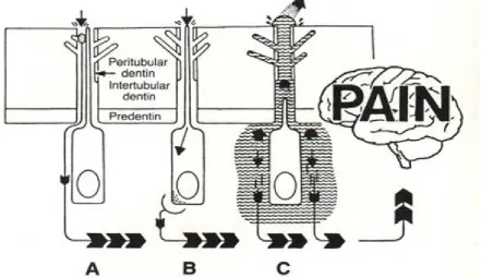 Figure 1: The schematic picture of the propped theories on DH  