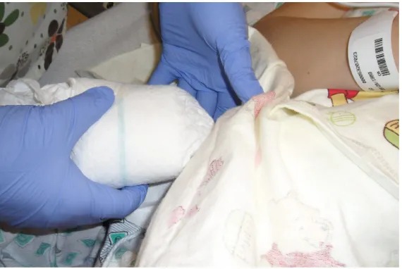 Figure 1. SSC position before the procedures. 