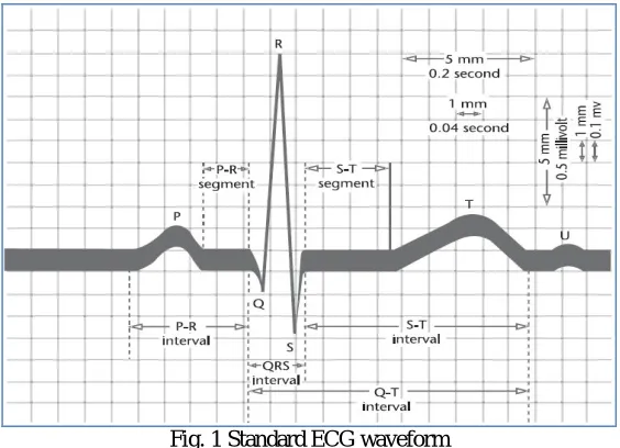 Fig. 1 Standard ECG waveform 